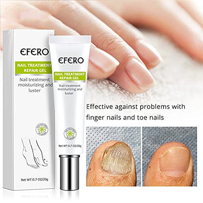 Gel para tratamiento de uñas