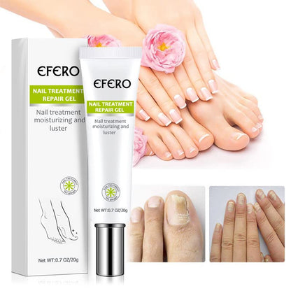 Gel para tratamiento de uñas